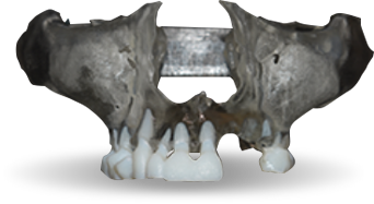 CT Anatomical Model Only Order