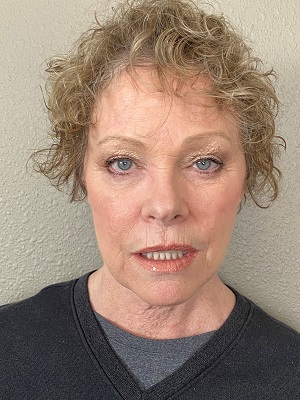 Rested, Lips Slightly Parted Rested, Lips Slightly Parted