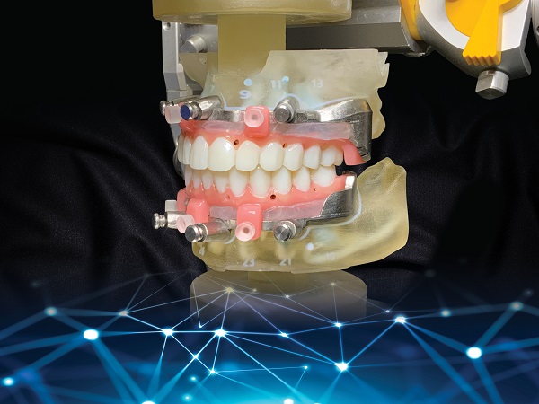 Guided Prosthetics Kit